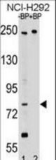 Western blot of APPL2 Antibody antibody pre-incubated without(lane 1) and with(lane 2) blocking peptide in NCI-H292 cell line lysate. APPL2 Antibody (arrow) was detected using the purified antibody.