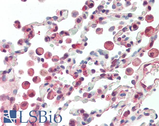 Anti-APRT antibody IHC staining of human lung. Immunohistochemistry of formalin-fixed, paraffin-embedded tissue after heat-induced antigen retrieval. Antibody LS-B10419 concentration 5 ug/ml.