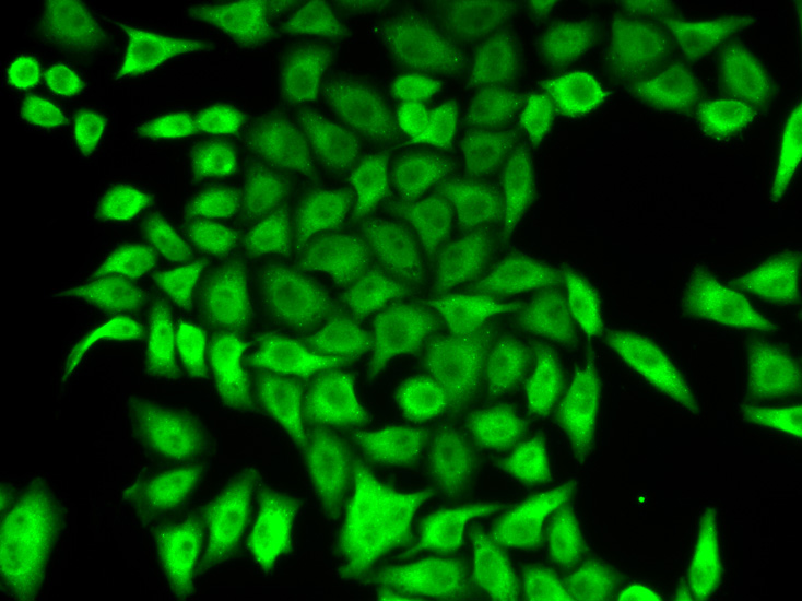 Immunofluorescence analysis of A549 cell using APRT antibody.