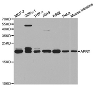 Western blot analysis of extracts of various cell lines, using APRT antibody.