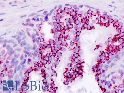 Human, Prostate: Formalin-Fixed Paraffin-Embedded (FFPE)