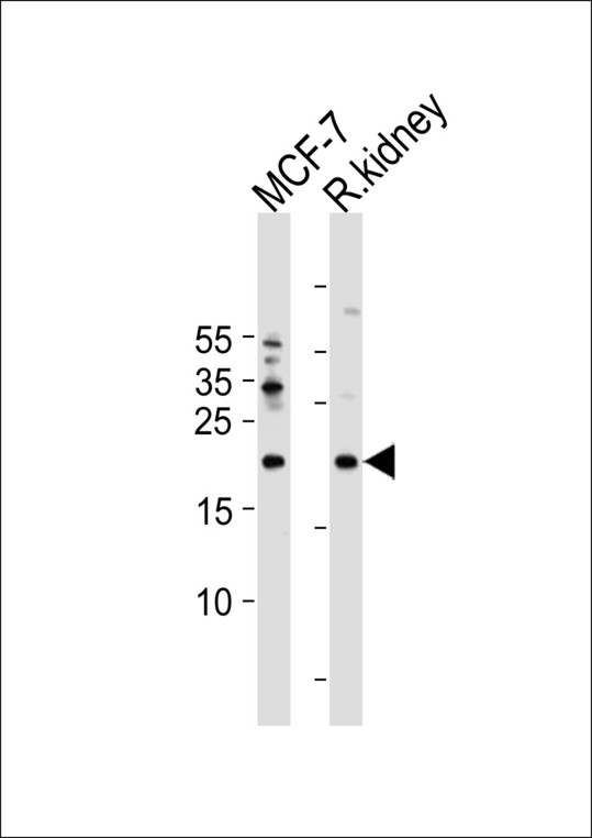 APRT Antibody western blot of MCF-7 cell line and rat kidney tissue lysates (35 ug/lane). The APRT antibody detected the APRT protein (arrow).