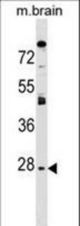 AQP1 Antibody western blot of mouse brain tissue lysates (35 ug/lane). The AQP1 antibody detected the AQP1 protein (arrow).
