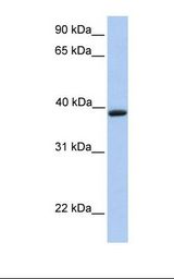 Jurkat cell lysate. Antibody concentration: 1.0 ug/ml. Gel concentration: 12%.