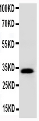 WB of AQP10 / Aquaporin 10 antibody. All lanes: Anti-AQP10 at 0.5ug/ml. WB: COLO320 Whole Cell Lysate at 40ug. Predicted bind size: 32KD. Observed bind size: 32KD.