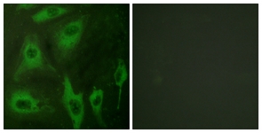 Immunofluorescence of HeLa cells, using Aquaporin 2 (Ab-256) Antibody. The picture on the right is treated with the synthesized peptide.