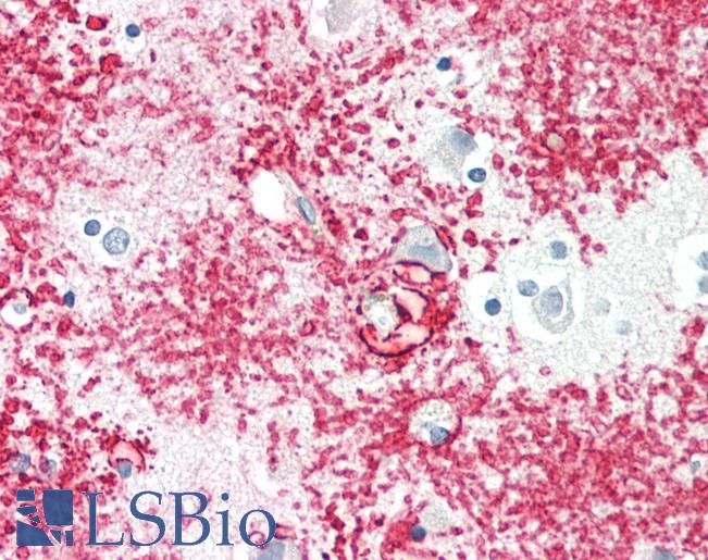 Human Brain, Cortex: Formalin-Fixed, Paraffin-Embedded (FFPE)