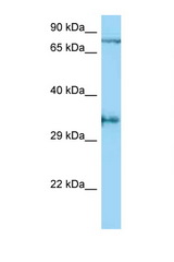 AQP4 / Aquaporin-4 antibody western blot of MDA-MB435 whole cell lysate. Antibody concentration 1 ug/ml.