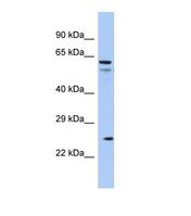 Western blot of Human COLO205. AQP5 antibody dilution 1.0 ug/ml.