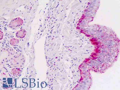 Anti-AQP5 / Aquaporin 5 antibody IHC staining of human lung. Immunohistochemistry of formalin-fixed, paraffin-embedded tissue after heat-induced antigen retrieval.
