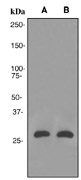 Western blot analysis on (A) fetal lung and (B) SW480 cell lysates using anti-Aquaporin 5 antibody (LS-B8978).
