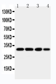 WB of AQP5 / Aquaporin 5 antibody. All lanes: Anti-AQP5 at 0.5ug/ml. Lane 1: MM453 Whole Cell Lysate at 40ug. Lane 2: MM231 Whole Cell Lysate at 40ug. Lane 3: SMMC Whole Cell Lysate at 40ug. Lane 4: SW620 Whole Cell Lysate at 40ug. Predicted bind size: 29KD. Observed bind size: 33KD.