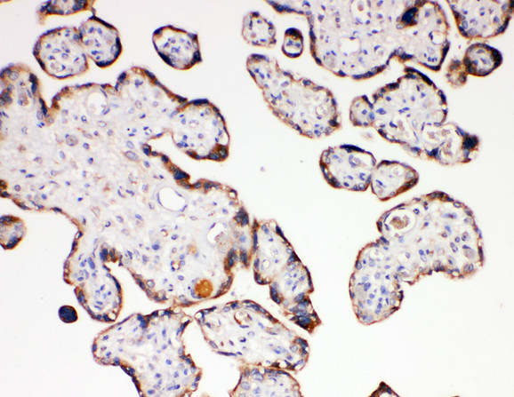 AQP6 / Aquaporin 6 antibody. IHC(P): Human Placenta Tissue.