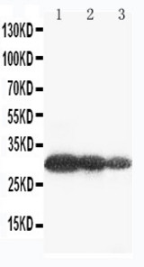 WB of AQP6 / Aquaporin 6 antibody. Lane 1: U87 Cell Lysate. Lane 2: COLO320 Cell Lysate. Lane 3: MCF-7 Cell Lysate.