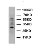 WB of AQP8 / Aquaporin 8 antibody. WB: A431 Cell Lysate.