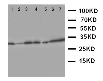 WB of AQP9 / Aquaporin 9 antibody. Lane 1: Mouse Liver Tissue Lysate. Lane 2: Mouse Lung Tissue Lysate. Lane 3: Mouse Spleen Tissue Lysate. Lane 4: Mouse Testis Tissue Lysate. Lane 5: PC-12 Cell Lysate. Lane 6: NIH3T3 Cell Lysate. Lane 7: HEPA Cell Lysate.