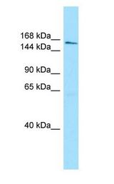 AQR antibody Western Blot of MCF7.