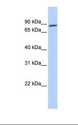 Jurkat cell lysate. Antibody concentration: 1.0 ug/ml. Gel concentration: 12%.