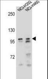 AR Antibody western blot of NCI-H292,NCI-H460 cell line lysates (35 ug/lane). The AR antibody detected the AR protein (arrow).