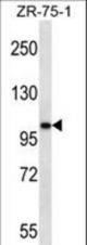 AR Antibody western blot of ZR-75-1 cell line lysates (35 ug/lane). The AR antibody detected the AR protein (arrow).