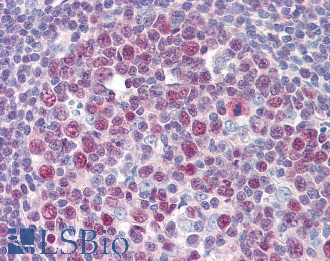 Anti-TGFB1I1 / HIC-5 antibody IHC of human tonsil. Immunohistochemistry of formalin-fixed, paraffin-embedded tissue after heat-induced antigen retrieval. Antibody LS-B3528 concentration 5 ug/ml.