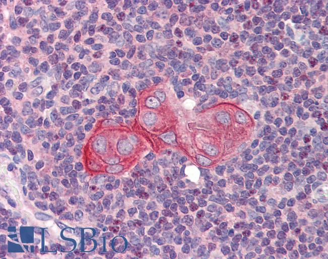 Anti-TGFB1I1 / HIC-5 antibody IHC of human thymus. Immunohistochemistry of formalin-fixed, paraffin-embedded tissue after heat-induced antigen retrieval. Antibody LS-B3528 concentration 5 ug/ml.