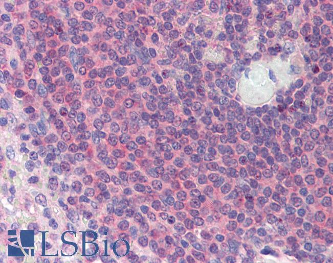 Anti-TGFB1I1 / HIC-5 antibody IHC of human spleen. Immunohistochemistry of formalin-fixed, paraffin-embedded tissue after heat-induced antigen retrieval. Antibody LS-B3528 concentration 5 ug/ml.