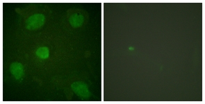 Immunofluorescence of HeLa cells, using Hic-5 Antibody. The sample on the right was incubated with synthetic peptide.