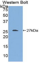 Western blot of recombinant ARA55 / HIC-5.