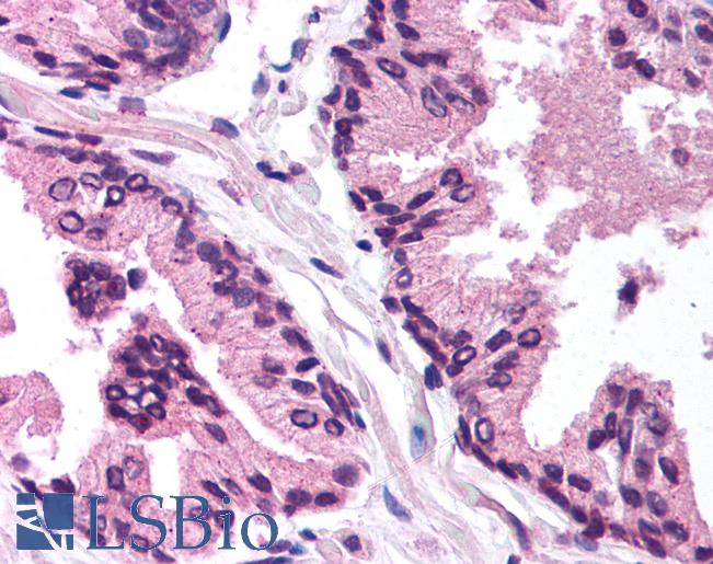 Anti-TGFB1I1 / HIC-5 antibody IHC of human prostate. Immunohistochemistry of formalin-fixed, paraffin-embedded tissue after heat-induced antigen retrieval. Antibody LS-B1004 concentration 5 ug/ml.