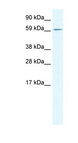 TGFB1I1 / HIC-5 antibody LS-B1004 Western blot of Fetal lung lysate.