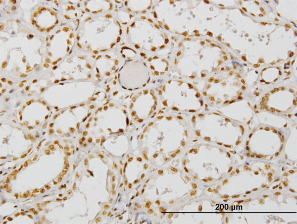 Immunoperoxidase of monoclonal antibody to NCOA4 on formalin-fixed paraffin-embedded human kidney. [antibody concentration 3 ug/ml]