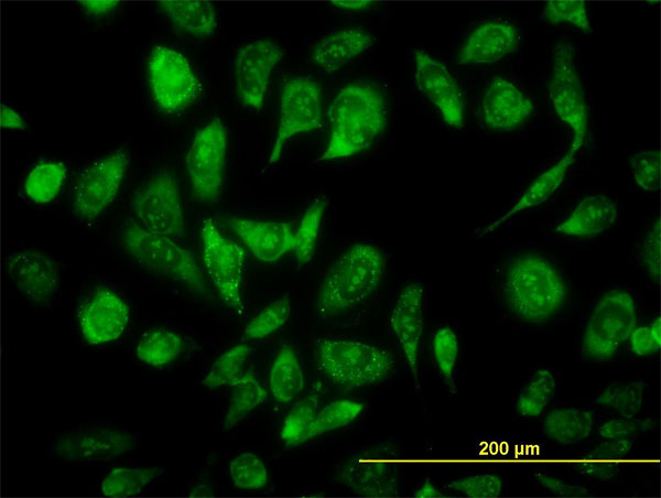 Immunofluorescence of monoclonal antibody to NCOA4 on HeLa cell. [antibody concentration 10 ug/ml]