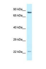 NCOA4 antibody LS-C145760 Western blot of MCF7 Cell lysate. Antibody concentration 1 ug/ml.