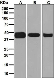 Western blot analysis on (A) HepG2, (B) 293T, and (C) HeLa cell lysates using anti-ACAA2 antibody.