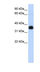AIP antibody LS-C112161 Western blot of Jurkat lysate.