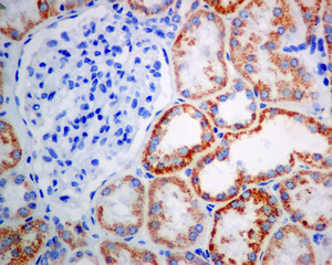 IHC of paraffin-embedded human kidney tissue using anti-ACAA2 antibody.