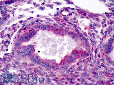 Anti-AIP antibody IHC of human endometrium. Immunohistochemistry of formalin-fixed, paraffin-embedded tissue after heat-induced antigen retrieval. Antibody LS-B227 dilution 1:400.