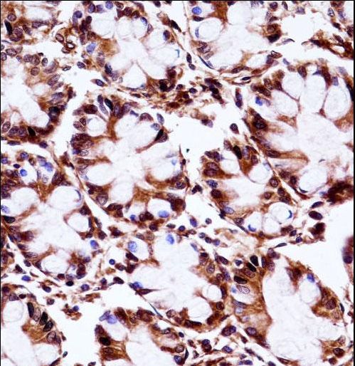 AIP Antibody immunohistochemistry of formalin-fixed and paraffin-embedded human rectum tissue followed by peroxidase-conjugated secondary antibody and DAB staining.