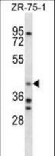 AIP Antibody western blot of ZR-75-1 cell line lysates (35 ug/lane). The AIP antibody detected the AIP protein (arrow).