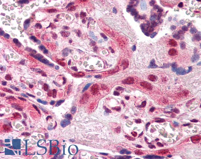 Anti-AIP antibody IHC of human placenta. Immunohistochemistry of formalin-fixed, paraffin-embedded tissue after heat-induced antigen retrieval. Antibody LS-B2603 concentration 5 ug/ml.