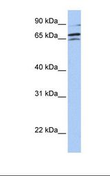 Fetal brain lysate. Antibody concentration: 1.0 ug/ml. Gel concentration: 12%.