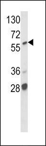 Western blot of hARAF1-H270 in MCF7 cell line lysates (35 ug/lane). ARAF1 (arrow) was detected using the purified antibody.