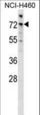 Mouse Araf Antibody western blot of NCI-H460 cell line lysates (35 ug/lane). The Araf antibody detected the Araf protein (arrow).