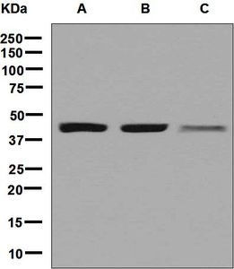 Western blot analysis on (A) HeLa, (B) Caco-2, and (C) HepG2 cell lysates using anti-ACAA2 antibody.