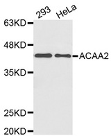 Western blot analysis of extracts of various cell lines, using ACAA2 antibody.