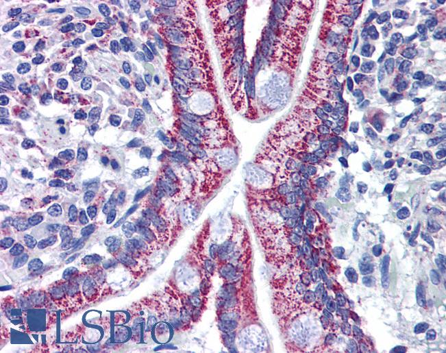 Anti-ACAA2 antibody IHC of human small intestine. Immunohistochemistry of formalin-fixed, paraffin-embedded tissue after heat-induced antigen retrieval. Antibody LS-B6206 concentration 3 ug/ml.