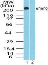 Western blot of ARAP2 in human kidney lysate in the 1) absence and 2) presence of immunizing peptide using LS-C148546 at 1.0 ug/ml. Goat anti-rabbit Ig HRP secondary antibody, and PicoTect ECL substrate solution, were used for this test.