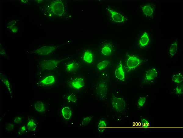 Immunofluorescence of monoclonal antibody to ACAA2 on HeLa cell. [antibody concentration 40 ug/ml]