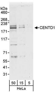 Detection of Human CENTD1 by Western Blot. Samples: Whole cell lysate (5, 15 and 50 ug) from HeLa cells. Antibodies: Affinity purified rabbit anti-CENTD1 antibody used for WB at 0.4 ug/ml. Detection: Chemiluminescence with an exposure time of 30 seconds.